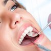Leczenie kanałowe zęba dwukanałowego (tradycyjne)