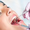 Ponowne leczenie kanałowe zęba dwukanałowego (re-endo)