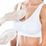 Powiększanie piersi implantem anatomicznym Powiększanie piersi implantem anatomicznym