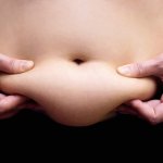 Klasyczna liposukcja brzucha