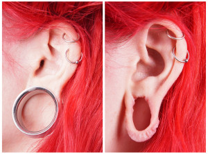 Rekonstrukcja rozerwanego płatka ucha